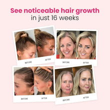 Load image into Gallery viewer, trybello Hair Growth Shampoo
