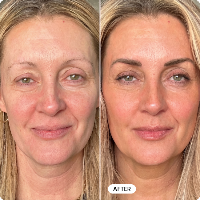 Bello Eyebrow Serum
